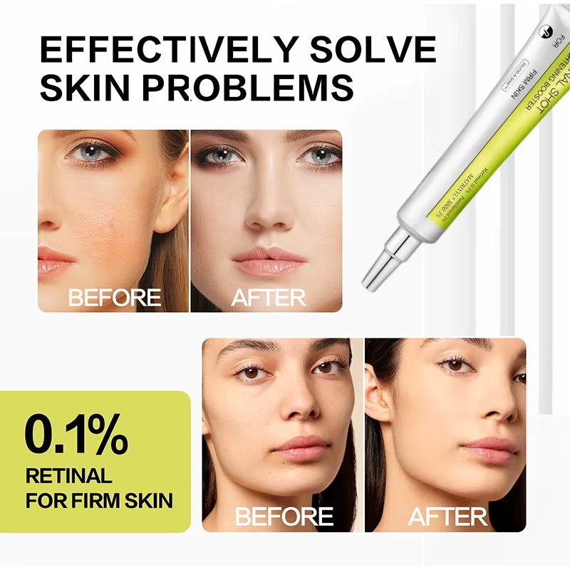 Routine Rétinol Expert Lumeasoin™ — Crème Yeux + Sérum Visage + Sérum Glow